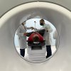 1ª sessão de radioterapia com acelerador linear é realizada!